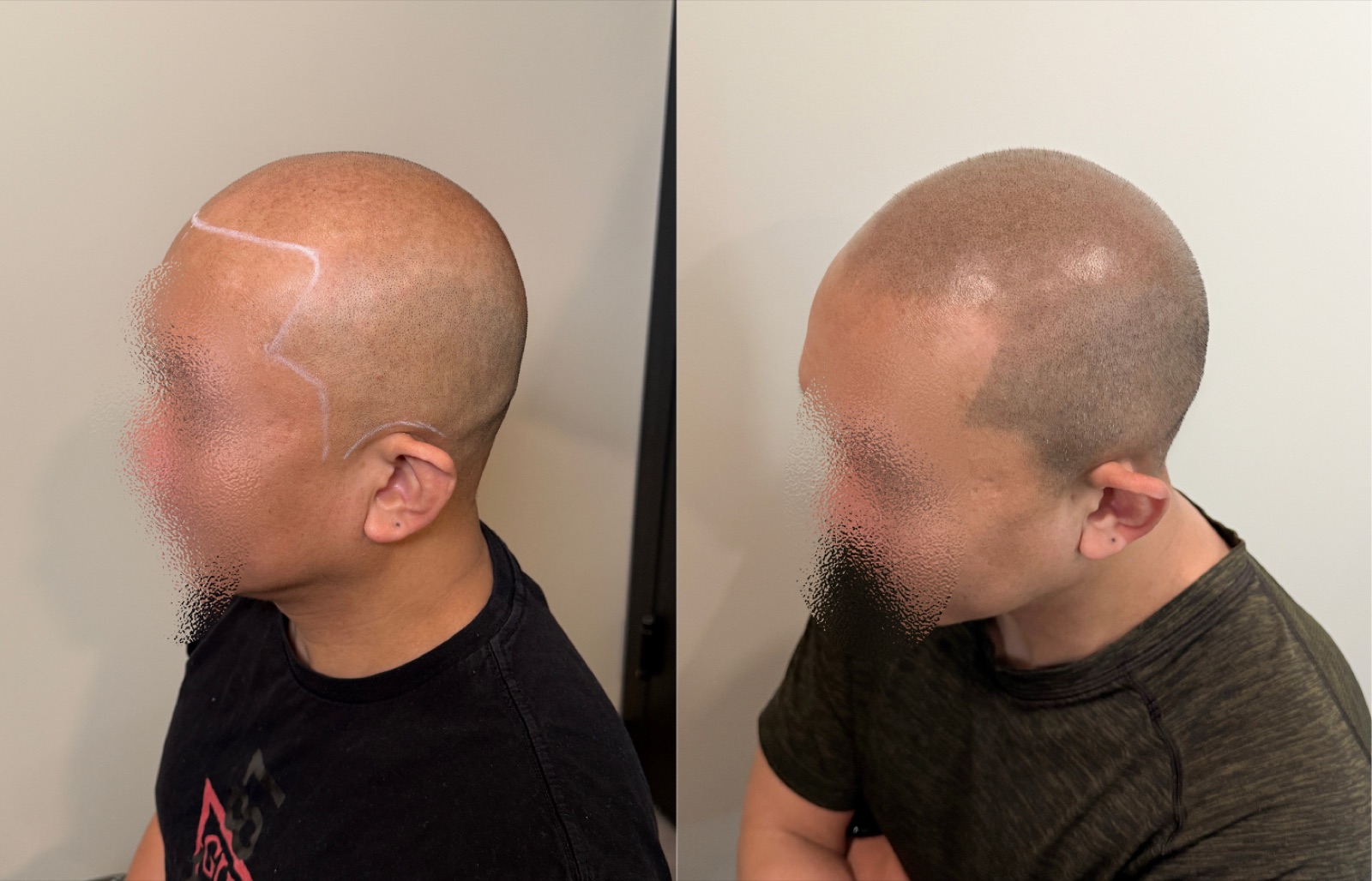 Shaved look SMP portfolio 11